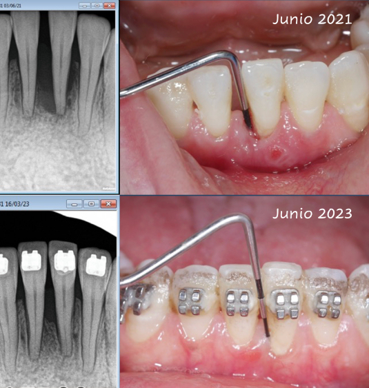 MÁSTER EN PERIODONCIA