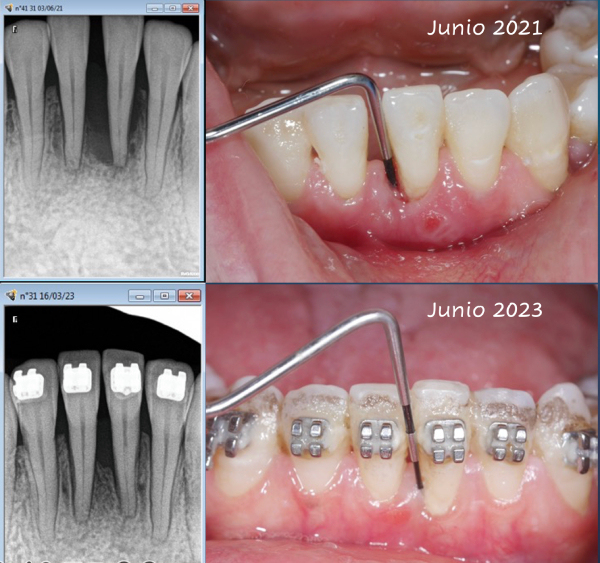 MÁSTER EN PERIODONCIA