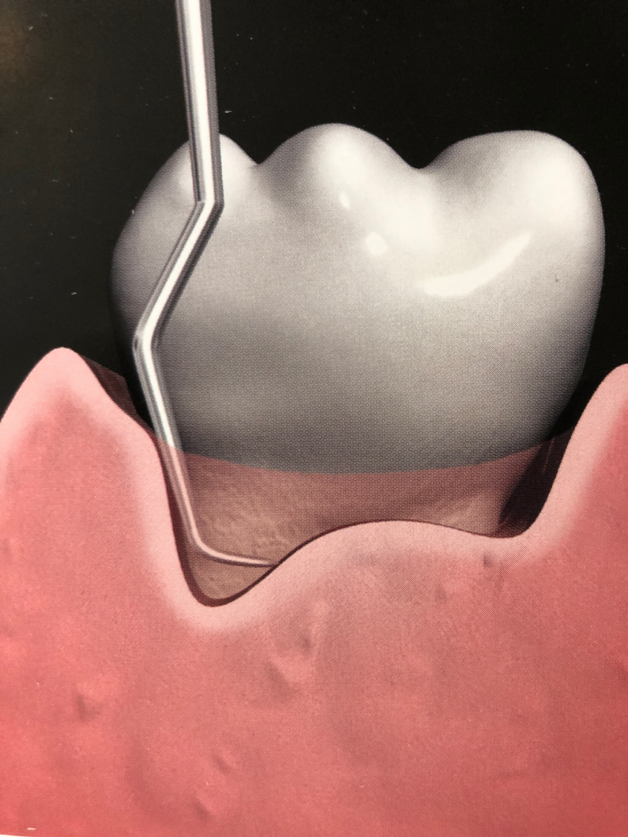 Terapia Periodontal Complementaria