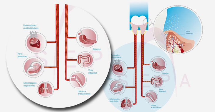 La interelación entre la periodoncia y la salud general