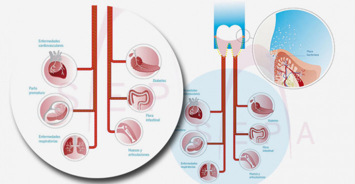 La interelación entre la periodoncia y la salud general