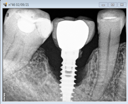 De la Periodoncia a la Implantología y a la Estética Dental